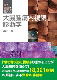 形と模様を極める 大腸腫瘍内視鏡診断学　第1版1刷