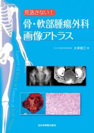 見逃さない!骨・軟部腫瘍外科画像アトラス　第1版1刷
